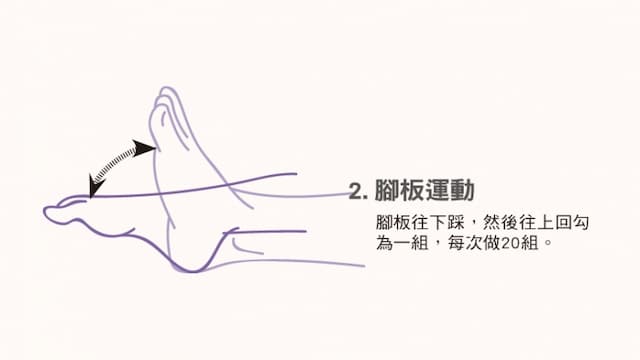 久站族必看！2招預防足底靜脈曲張/regimen/304708
