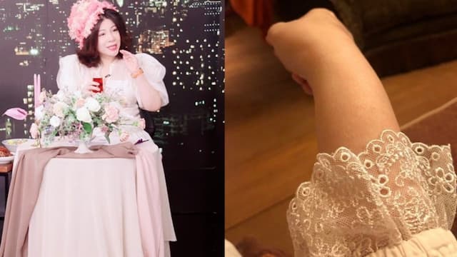 免疫系統攻擊自己！陳文茜臉手癱瘓、烏龜背 醫推測可能是這些病