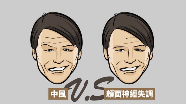 <span style="color:#1BA42B;">眼歪嘴斜</span>是中風嗎？一條紋路就能判斷！