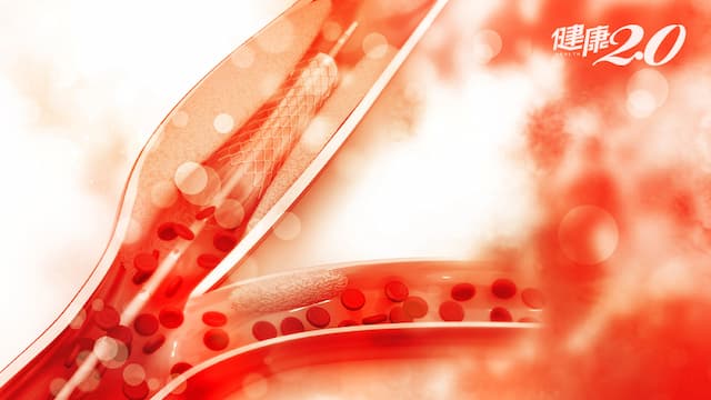 她頭暈、心悸、腹痛……竟是心肌梗塞！