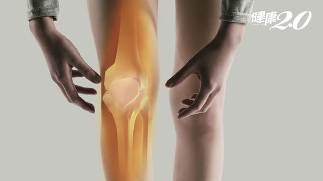 「膝」頭大患！退化性關節炎可以不開刀嗎？