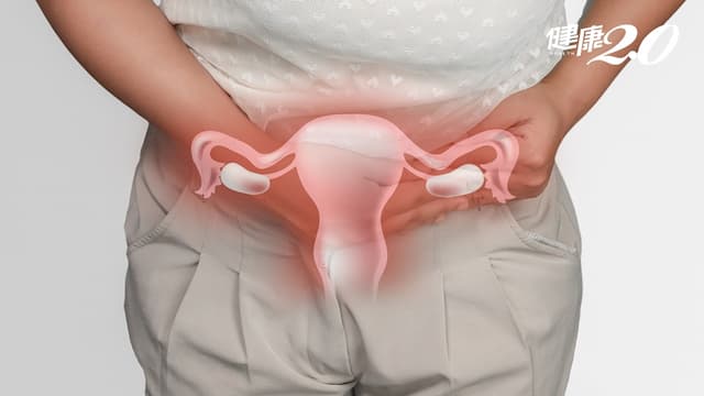 1/4育齡女性有子宮肌瘤…開不開刀？醫師這樣說