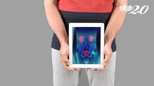 攝護腺癌早期無症狀  男人年過50每年都要做這2種檢查