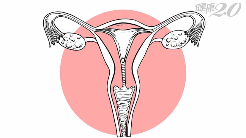 經期變短、血量變少？卵巢有沒有早衰，１張表評估危機/medical/314407