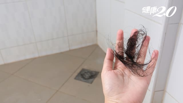 洗頭後，排水孔掉髮量讓你崩潰？身體在警告你缺了這個營養/regimen/315159