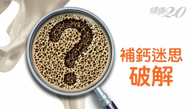 「骨鬆」補鈣就好不用吃藥？骨科醫師破解「５大錯誤」補鈣迷思
