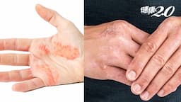 Search result thumbnail