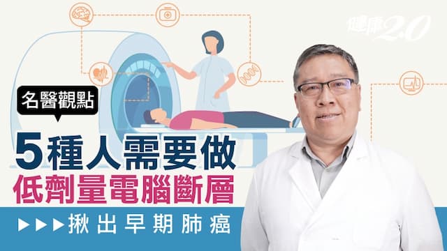 揪出早期肺癌！5種人最該做低劑量電腦斷層/medical/318866