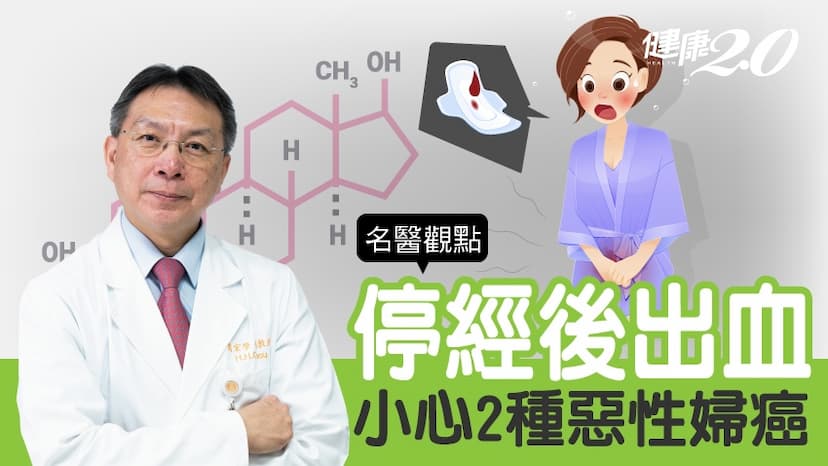 停經後經血又來了 別高興！小心2種婦癌上身/medical/319587