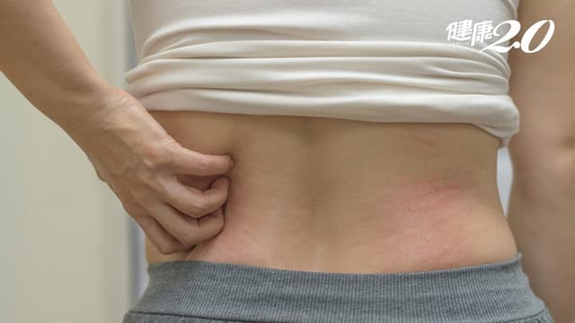 「冬季癢」沖熱水澡只會更癢！醫傳授「保濕效果最好」的做法/medical/320522