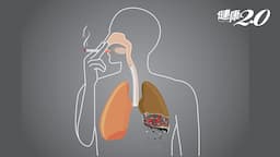 Search result thumbnail