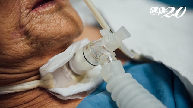 氣切就回不去了？加護病房醫師陳志金：生活品質反而更好！