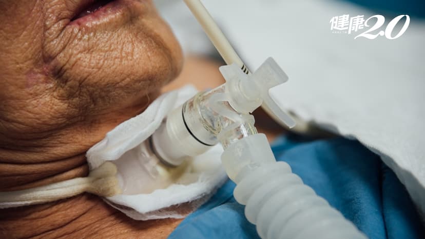 氣切就回不去了？加護病房醫師陳志金：生活品質反而更好！/medical/322635