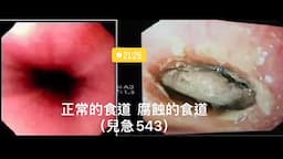 Search result thumbnail