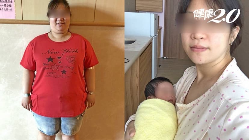 多囊性卵巢、月經沒來、不孕她都有！醫師做這件事全解決了/medical/324646