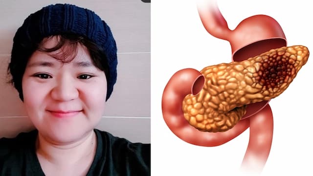 《屍速列車》女星46歲胰臟癌逝世！醫提醒：胃病一直好不了要注意