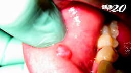 Search result thumbnail