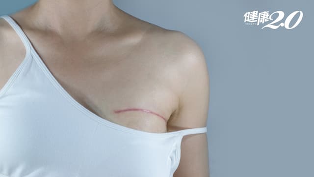 她27歲確診乳癌，「乳房切除」打擊太大！<span style="color:#1BA42B;">乳房重建</span>有哪些選擇？