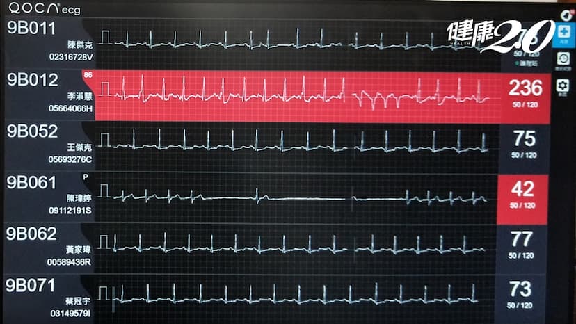 一年2300人心律不整猝死！北榮開發AI判讀心電圖 14天監測揪出漏網之魚/medical/326100