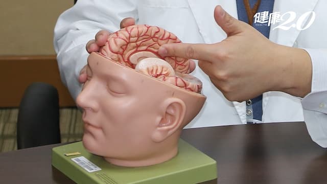 沒有三高也會腦中風？全台23萬人有特殊基因突變 中風風險高11倍！/medical/326329