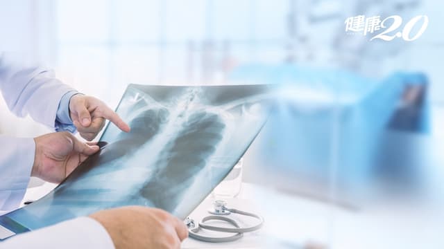 「新國病」肺癌12年蟬聯癌症死亡率首位！健檢發現肺結節是肺癌嗎？/cancer/326594