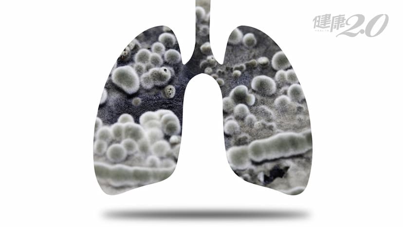 每54分鐘就有1人死於肺癌！高齡得肺癌該放棄治療嗎？/cancer/326639
