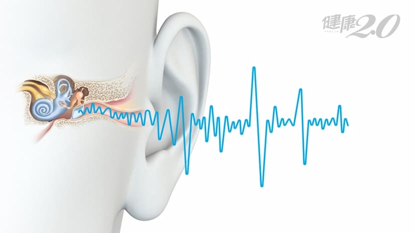 耳鳴有可能是腦部問題？耳鳴什麼情況需要做腦部影像檢查？/medical/327476