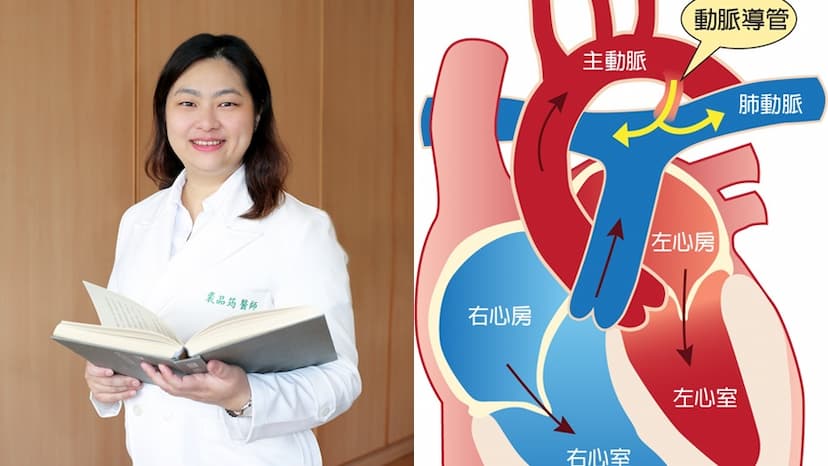 兒童心臟有雜音、容易累，恐是開放性動脈導管 2歲兒心導管治療「救心」/medical/329400