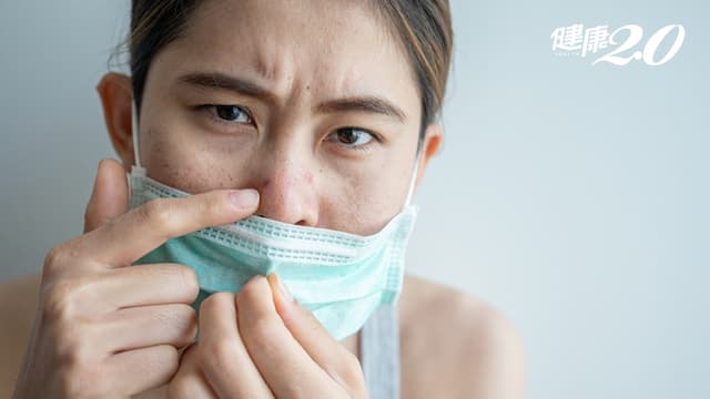 戴口罩狂長痘痘，如何改善？醫師3法寶 小心「吃這些」會讓痘痘惡化/medical/330055