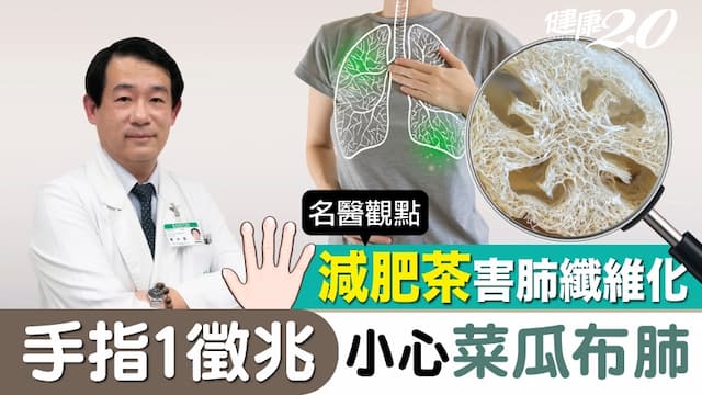 減肥茶竟喝出肺纖維化！醫曝警訊：看手指「1徵兆」小心<span style="color:#1BA42B;">菜瓜布肺</span>上身