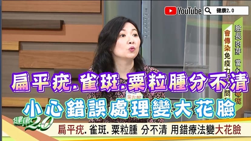 扁平疣、雀斑、粟粒腫分不清！小心錯誤處理變大花臉/review/330393