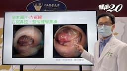 Search result thumbnail