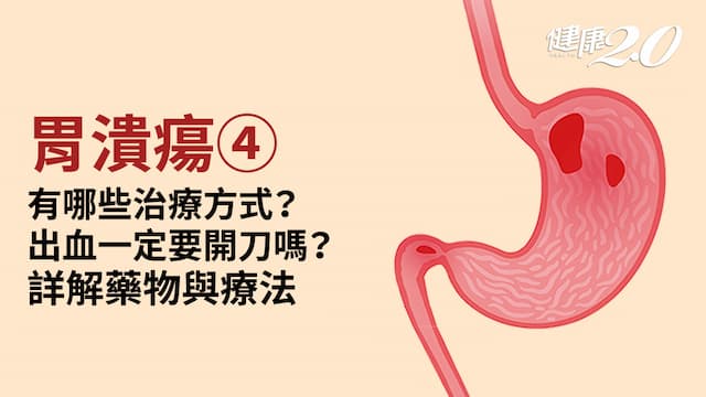胃潰瘍／療程需要多久？哪種藥物最有效？1種療法有效根除幽門螺旋桿菌
