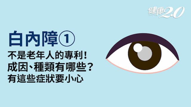 白內障／不只老人會得！成因、種類有哪些？出現這些症狀小心是前兆