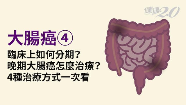 大腸癌／0～4期怎麼分？大腸癌可以活多久？4大治療方法一次詳解