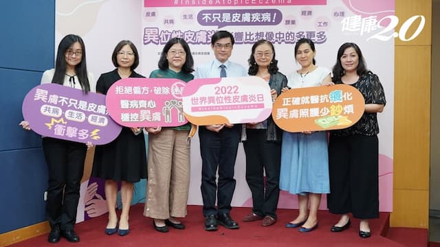 異位性皮膚炎「富貴病」？2成病人年自費逾10萬元！買保濕品和藥物止癢