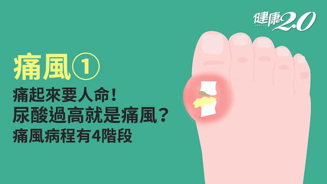 痛風／一陣風吹過都痛！尿酸與痛風息息相關？患上痛風有9大成因