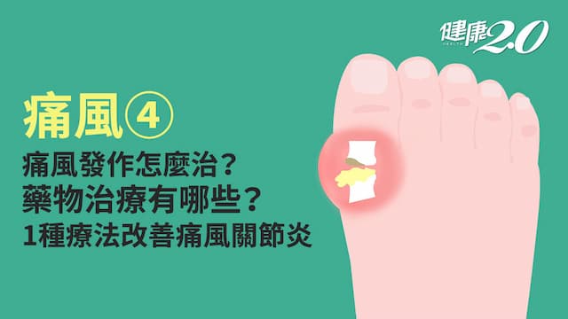 痛風／痛風如何治療？抗痛風藥秋水仙素怎麼吃？吃多會有副作用嗎？