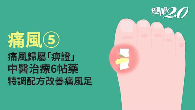 痛風／中醫如何治療痛風？用這6帖藥＋特調足浴 改善痰濕體質降尿酸