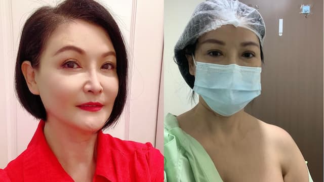 資深女星罹癌「巨大乳房腫瘤」！醫曝這種乳房腫瘤惡性機率高 1種人乳房疼痛當心是乳癌