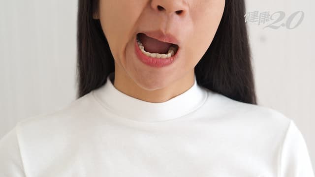 嘴歪眼斜未必是中風！中醫輔助治療顏面神經麻痺好得快 發病期做好眼睛護理很重要/tcm/336020