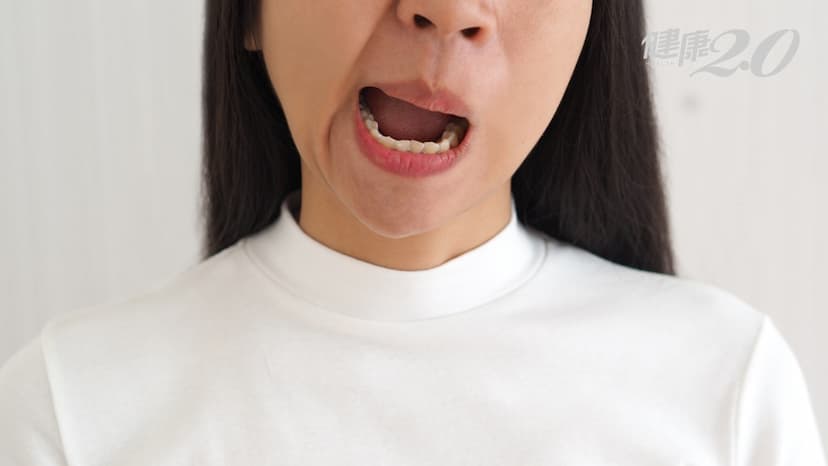 嘴歪眼斜未必是中風！中醫輔助治療顏面神經麻痺好得快 發病期做好眼睛護理很重要/tcm/336020