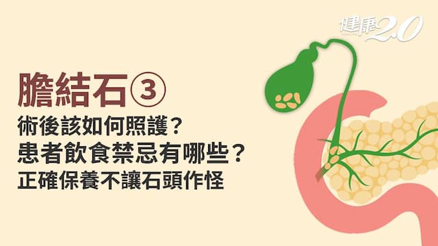 膽結石／膽結石病人怎麼吃？哪些飲食禁忌要注意？患者生活照護重點一次看