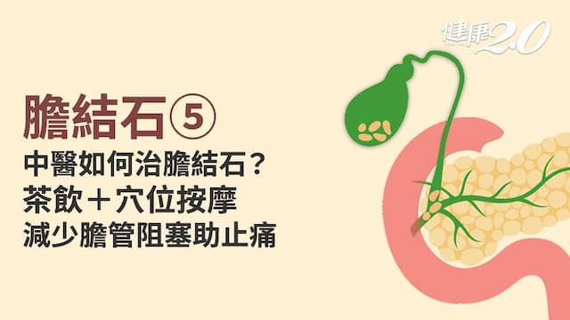 膽結石／中醫排石有方法！2茶飲疏肝利膽 2穴位止痛預防膽結石