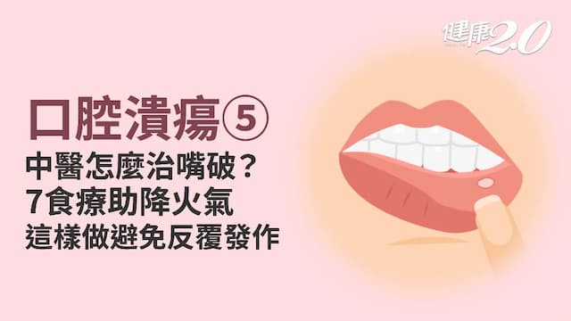 口腔潰瘍／中醫如何治療？7湯飲助調理降火氣 這樣做避免嘴破反覆發作