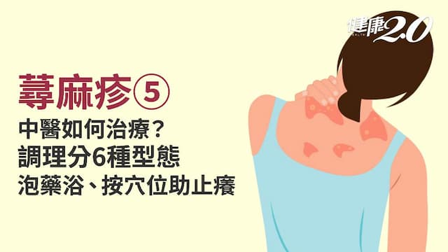 蕁麻疹／與風邪有關！中醫治療分6種型態 1泡澡方＋3穴位助止癢