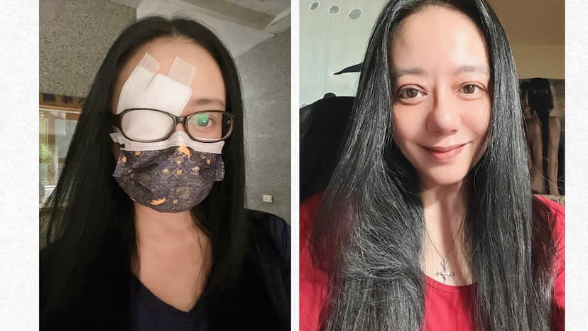 高慧君甲狀腺功能低下引發斜視、重影！視力出現「3情況」快驗抗體/medical/337213