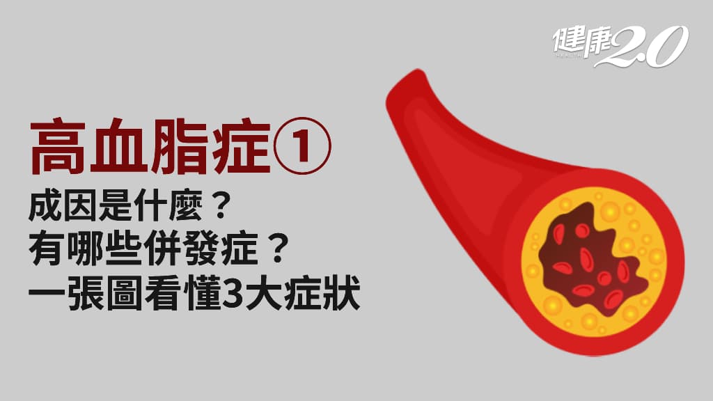 高血脂症／為什麼會血脂升高？高血脂症有哪些症狀？當心6大致命併發症