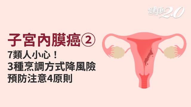 子宮內膜癌／如何預防子宮內膜癌？沒生育也是高危險群！快避開這些NG飲食