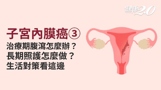 子宮內膜癌／4種慢性合併症怎緩解？ 照護方式與追蹤檢查全掌握
